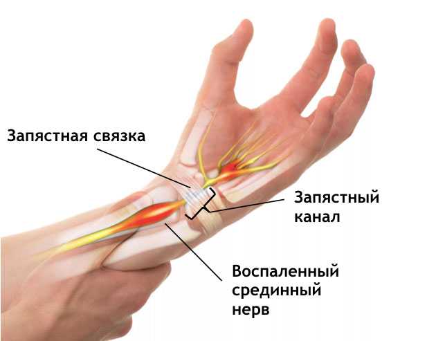 Что такое «техника запястья». девушки в тиктоке верят, что могут привлечь парня воображаемым поцелуем