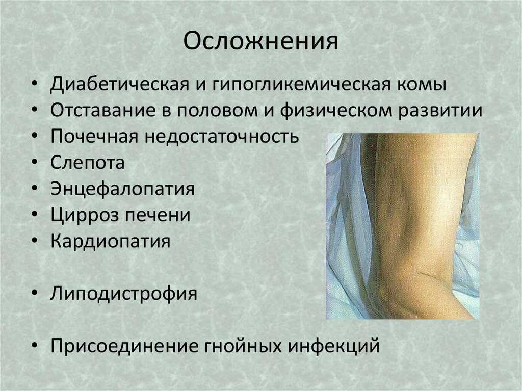 Один из первых заболевших коронавирусом рассказал, как протекала его болезнь - hi-news.ru