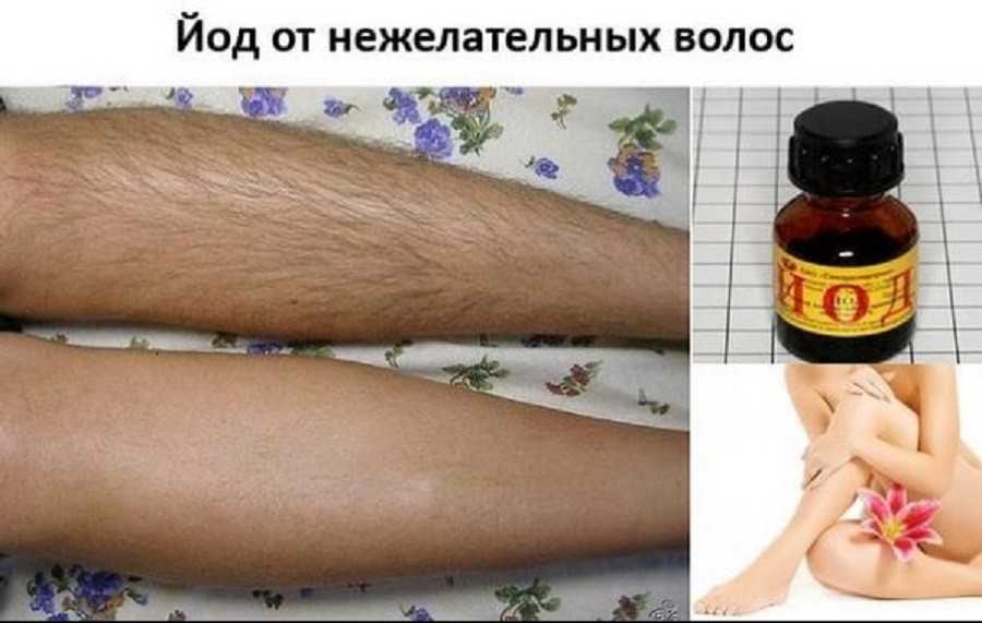 Надо ли брить волосы в интимной зоне? каково мужское мнение?