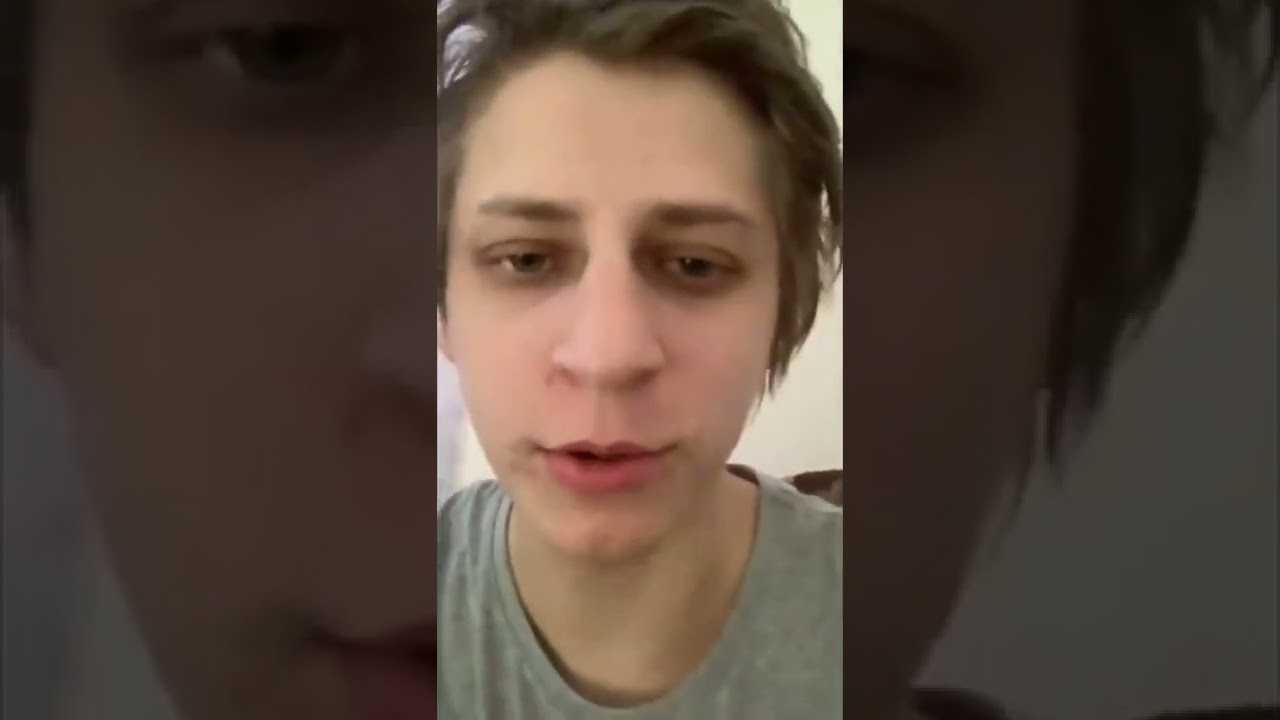 Ютубер Мамикс рассказал, почему две недели не выпускал новых видео Блогер попал в больницу из-за неудачного эксперимента с травмой руки