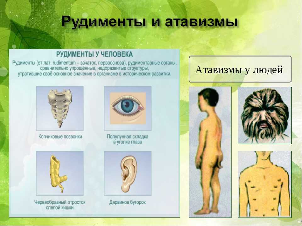 Атавизм викисловарь. что такое атавизм. мифов об атавизмах и рудиментах