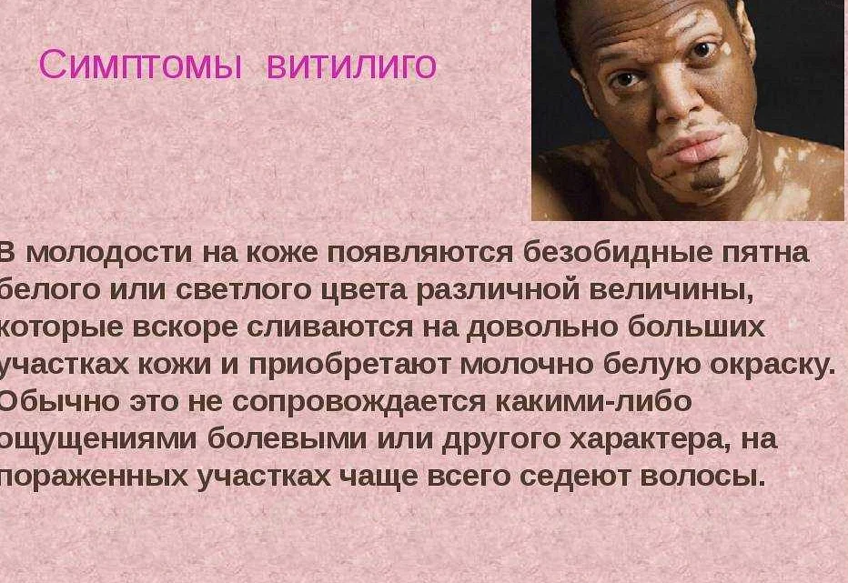 Что такое витилиго: причины, симптомы, лечение - медицинский центр на ботанической