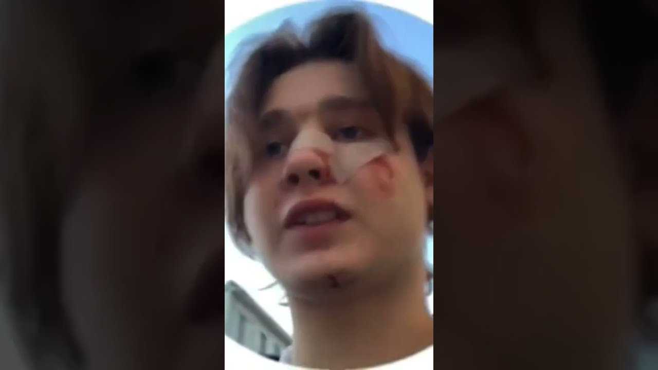 Чудесные метаморфозы шария: что произошло с популярным блогером