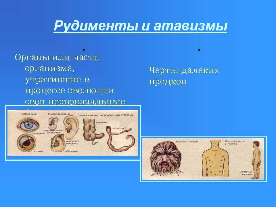 У человека рудиментами не являются. почему атавизмы проявляются далеко не у всех? атавизмы животных и растений