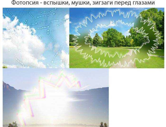 Почему на фото со вспышкой появляются красные глаза и можно ли это исправить?