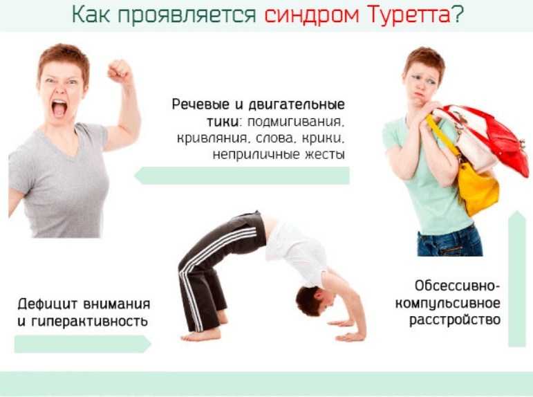 Синдром туретта у детей: 7 критериев диагностики и рекомендации для родителей