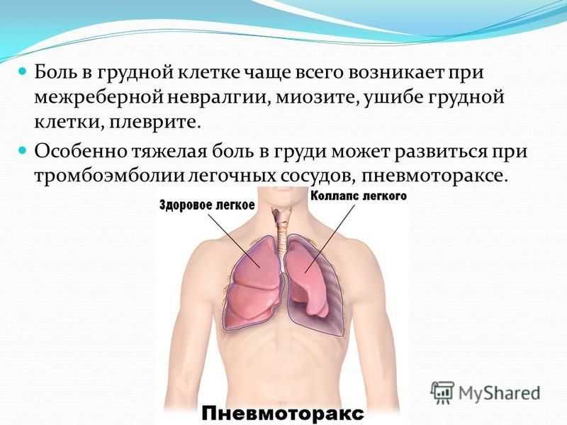 Спинальная анестезия - кому проводят такую процедуру и опасна ли она?