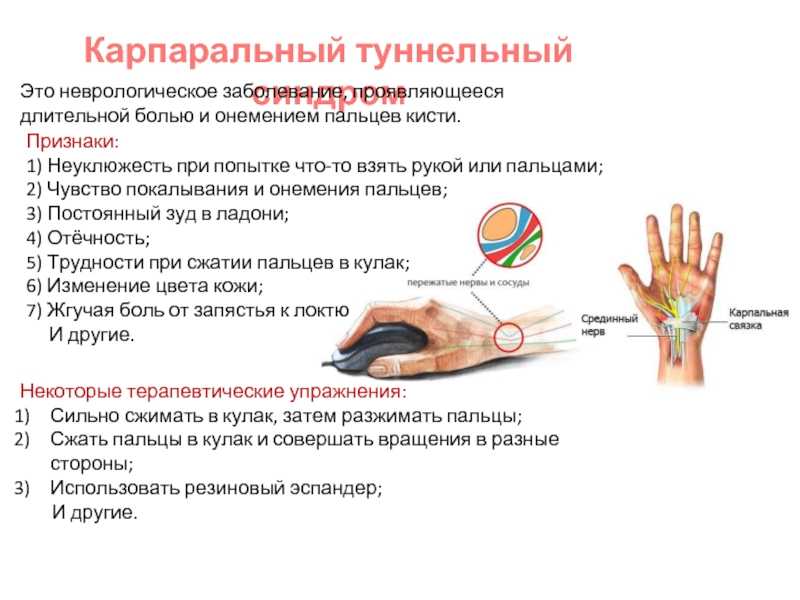 Держась рукой за тросточку как понять •  © юридическая помощь онлайн